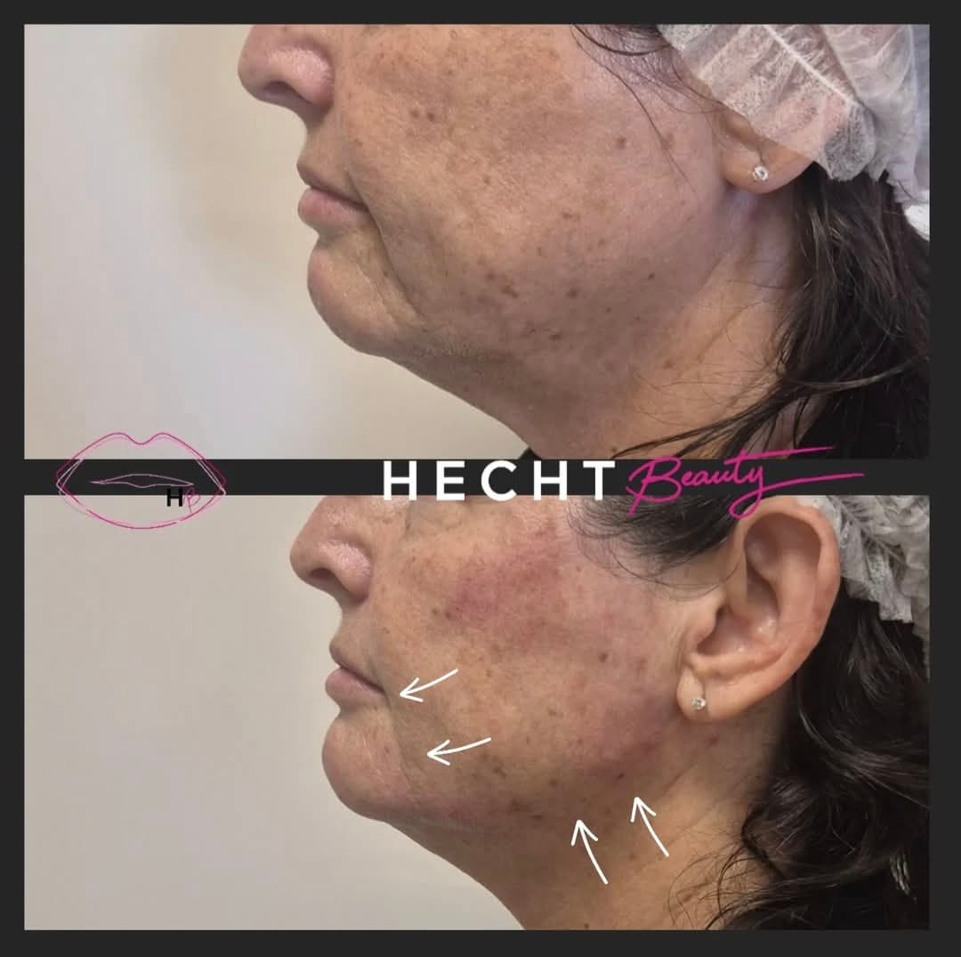 ביוסטימולטורים - Image 1